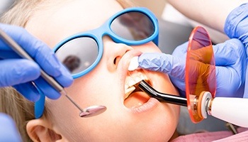 A young child wearing sunglasses while having dental work performed
