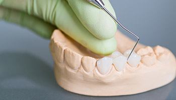 Plastic model of teeth with dental bridge
