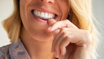 A woman calmly and gently putting an Invisalign tray over her teeth.
