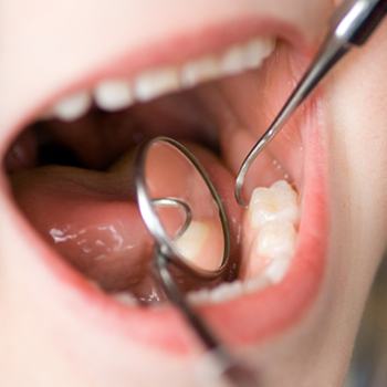 young girl at dental exam