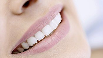 Close up of lady's stunningly beautiful teeth