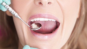 dentist examining female patient with dental mirror