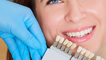 Woman's smile compared to teeth shading chart