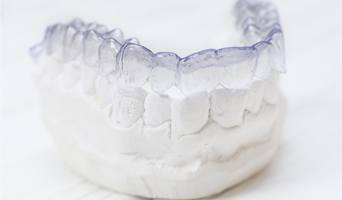 clear aligner on dental mold