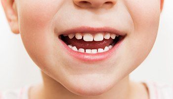 Close up of a young child's developing smile