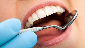 Close up of dentist examining patient teeth