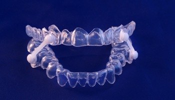 Oral appliance