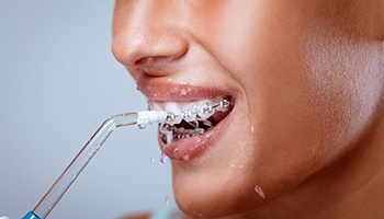 A woman using an oral irrigator to floss between her teeth