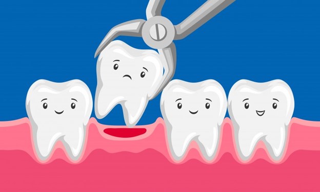 Cartoon picture of a tooth being extracted with forceps.