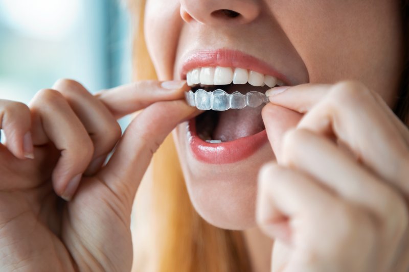 A woman placing her Invisalign clear aligners